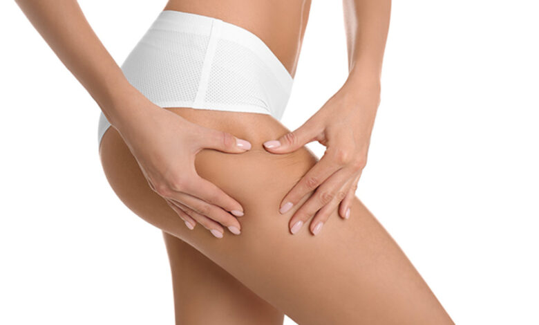 Medial Thigh Lift